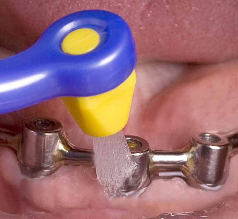 TePe Interspace Soft, zobna ščetka s 4 nastavki