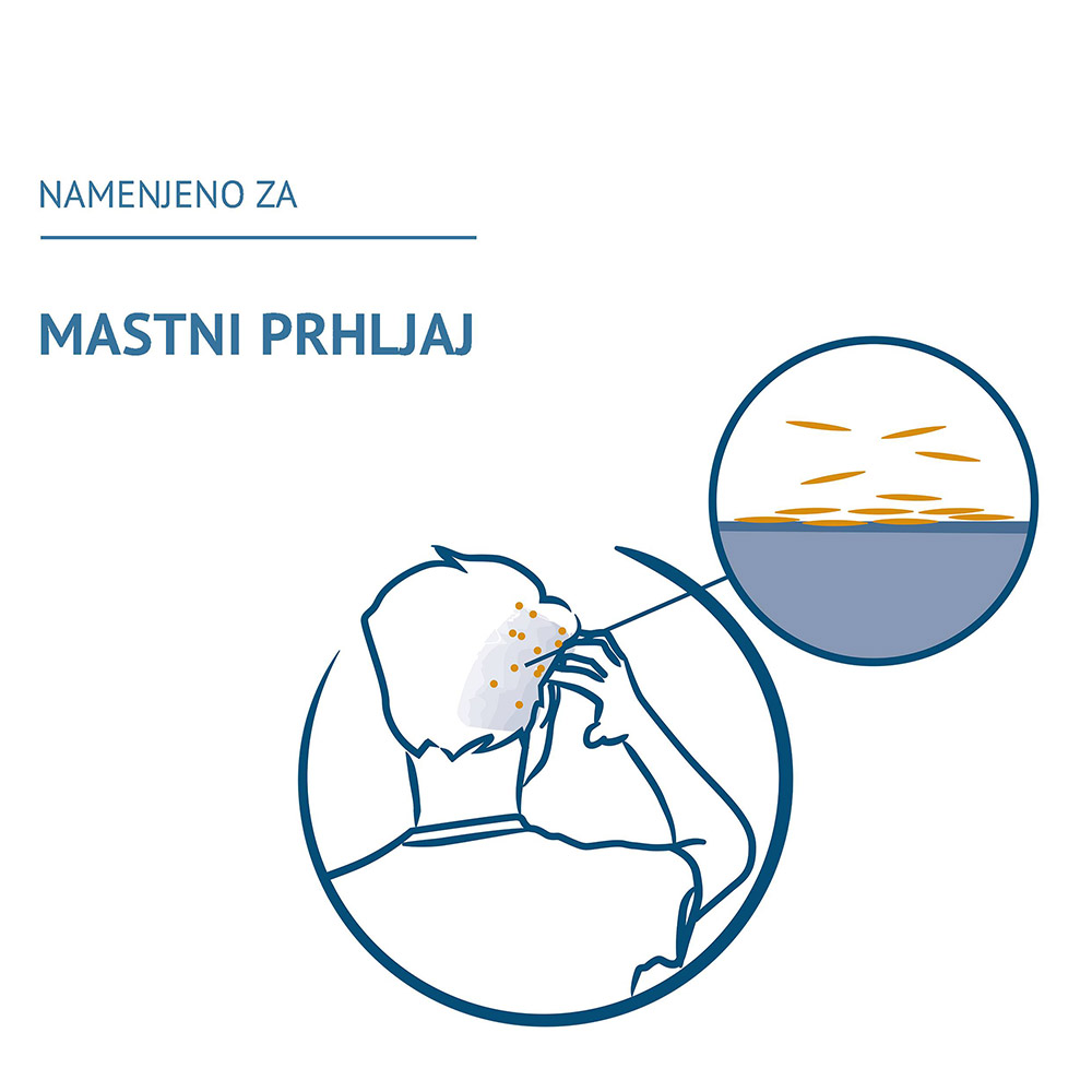 Ducray Squanorm, šampon za mastni prhljaj (200 ml)
