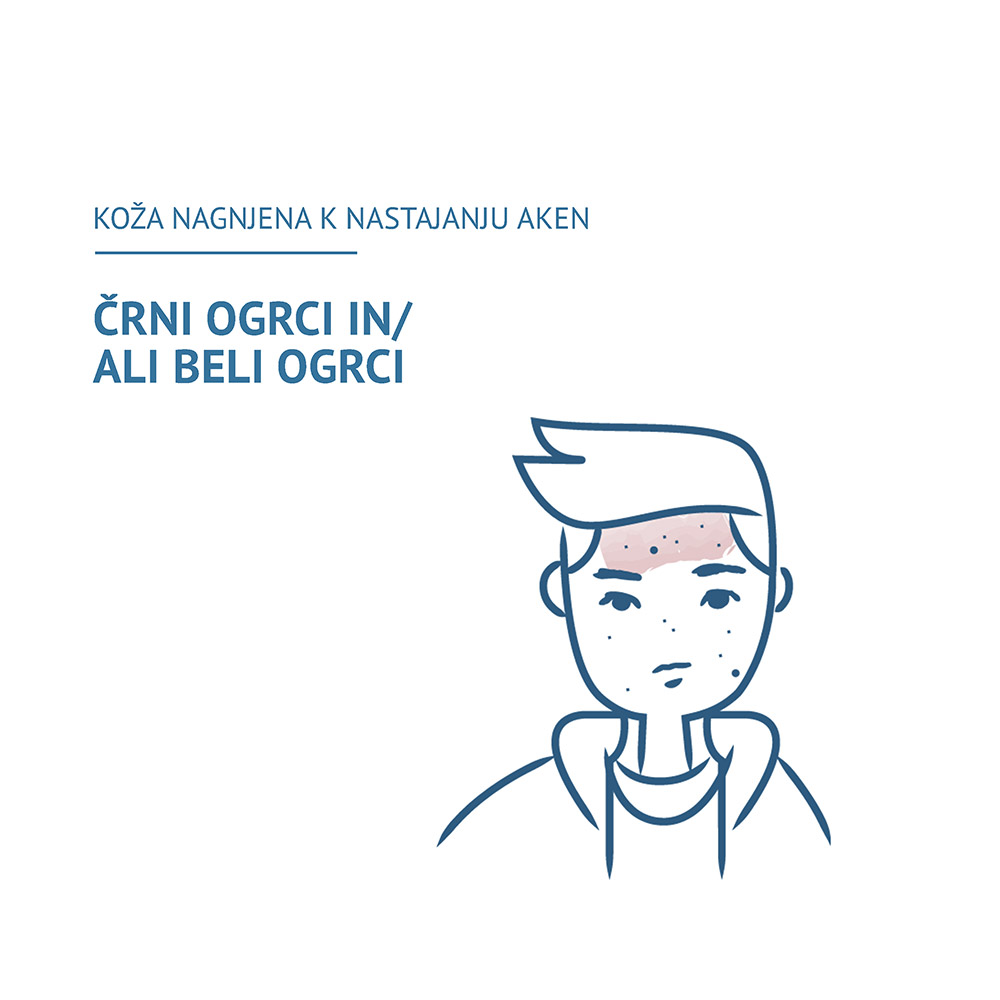 Ducray Keracnyl Glycolic+, krema za odpiranje por (30 ml)