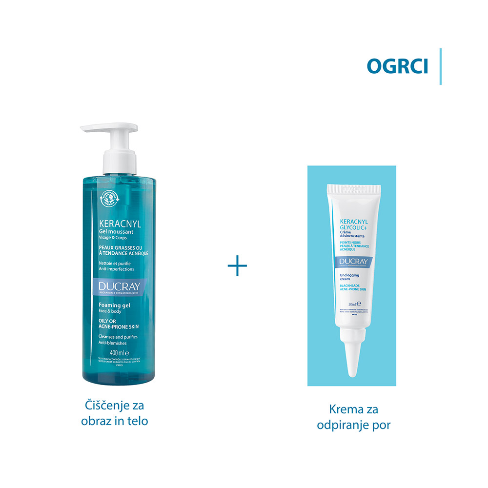 Ducray Keracnyl Glycolic+, krema za odpiranje por (30 ml)