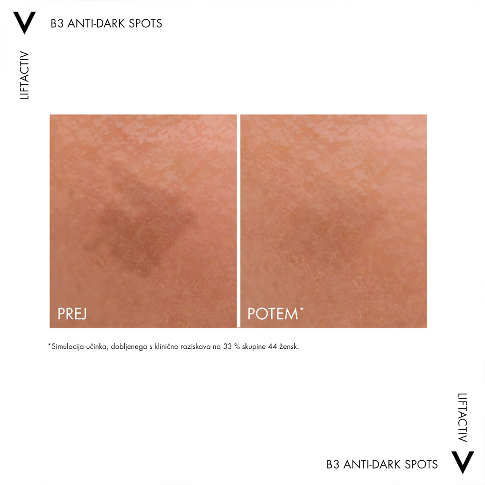 Vichy Liftactiv Specialist B3 Dark Spots, serum proti temnim lisam in gubam za obraz (30 ml)