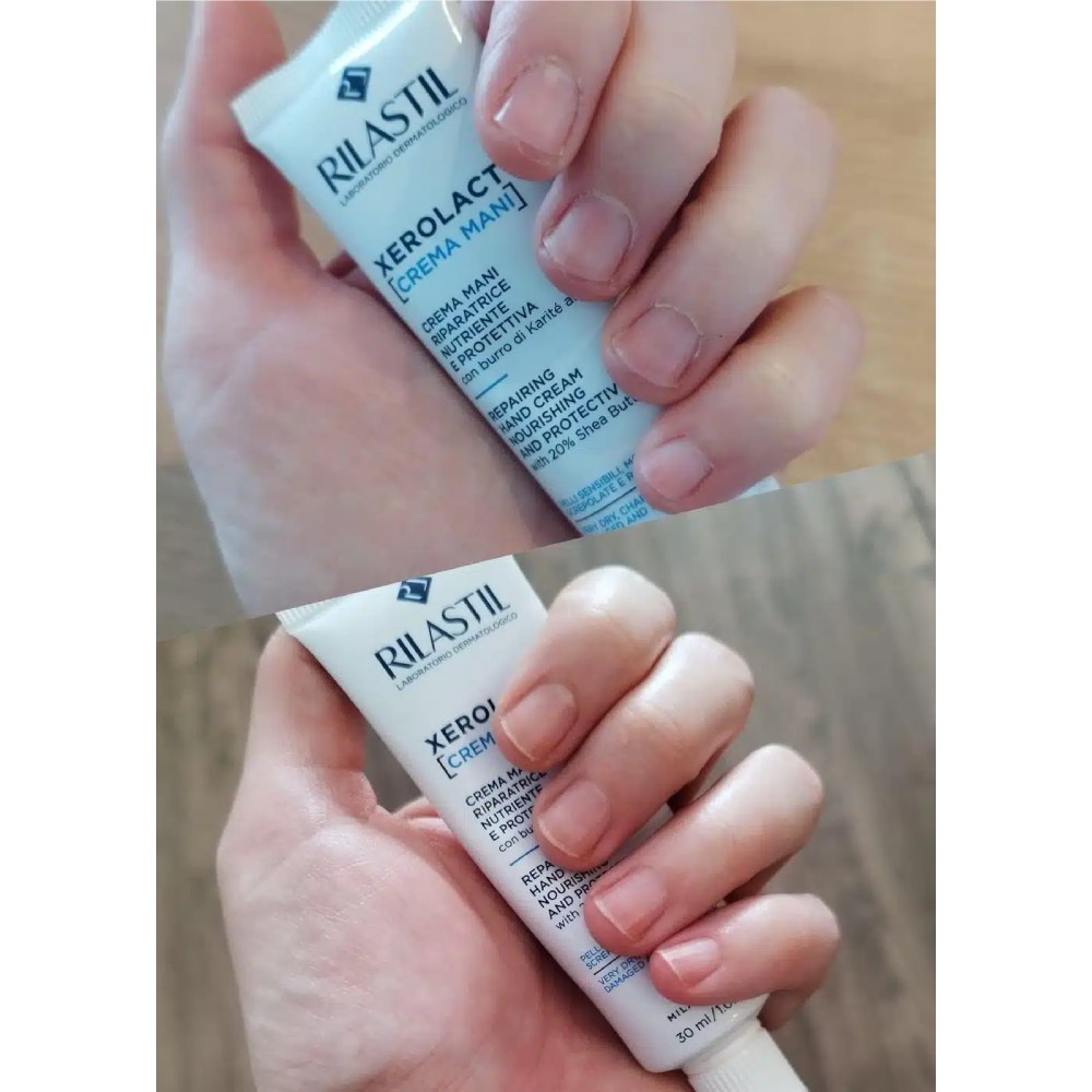 Rilastil Xerolact, obnovitvena krema za roke (100 ml)