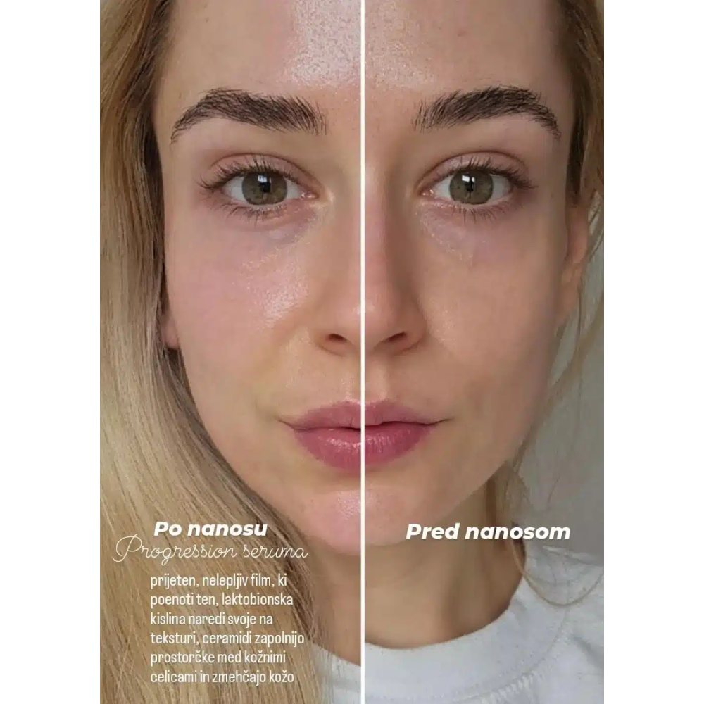 Rilastil Progression (+), serum (30 ml)