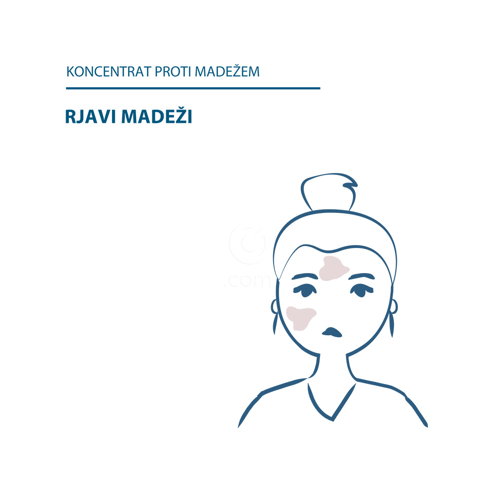 Ducray Melascreen, koncentrat proti madežem (30 ml)