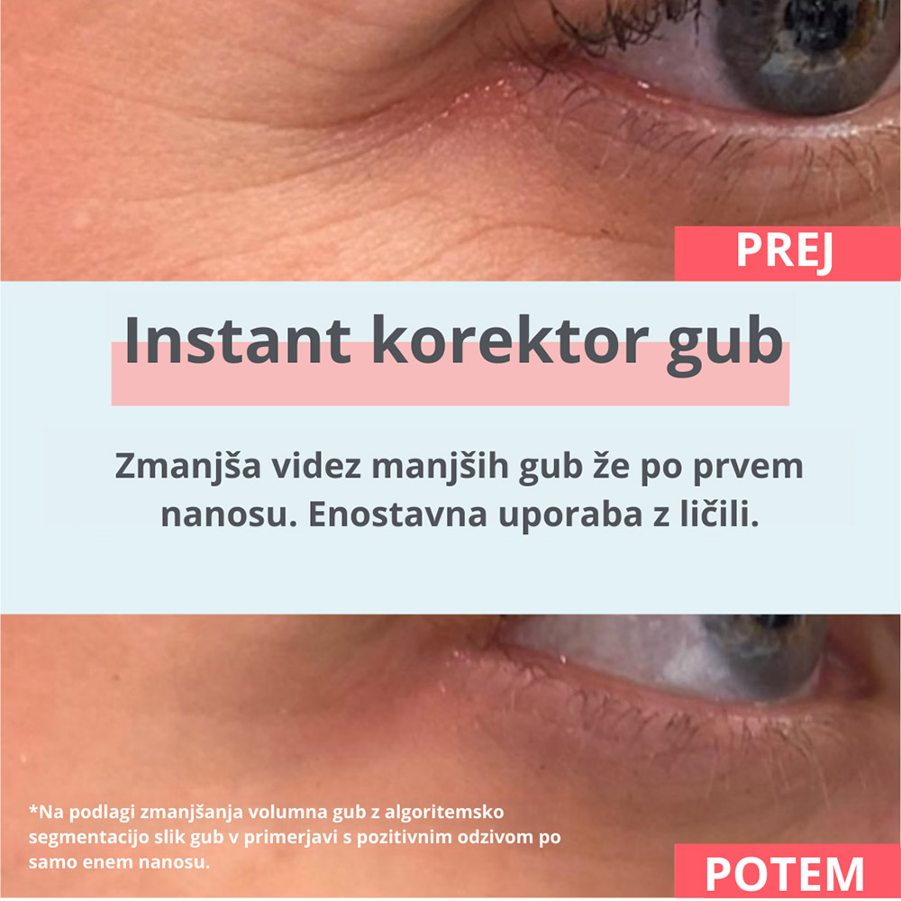 Remescar, instant korektor gub (8 ml)