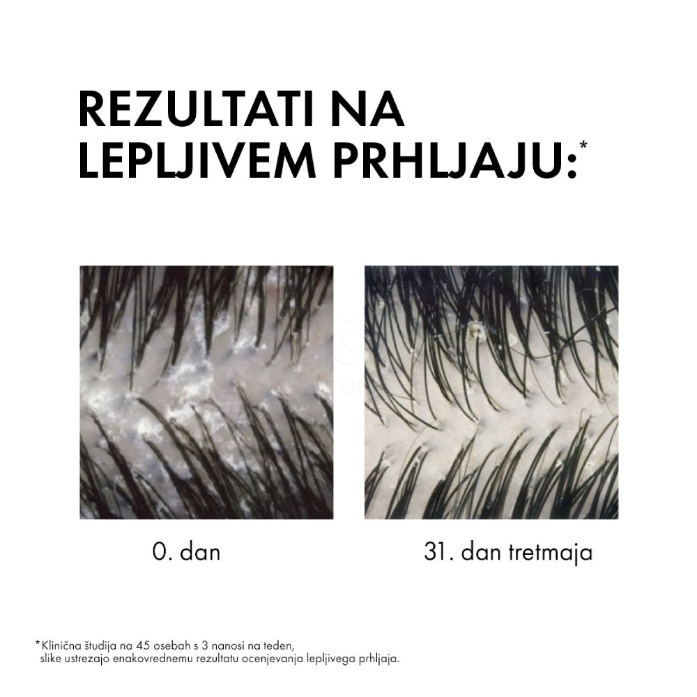 Vichy Dercos, šampon proti prhljaju za suhe lase (200 ml)