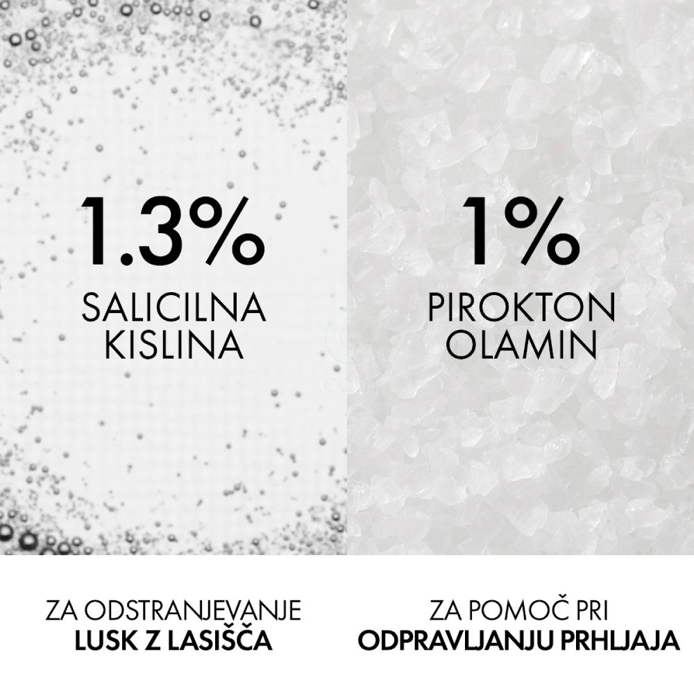 Vichy Dercos Anti dandruff K, šampon proti lepljivemu prhljaju in sebumu (250 ml)