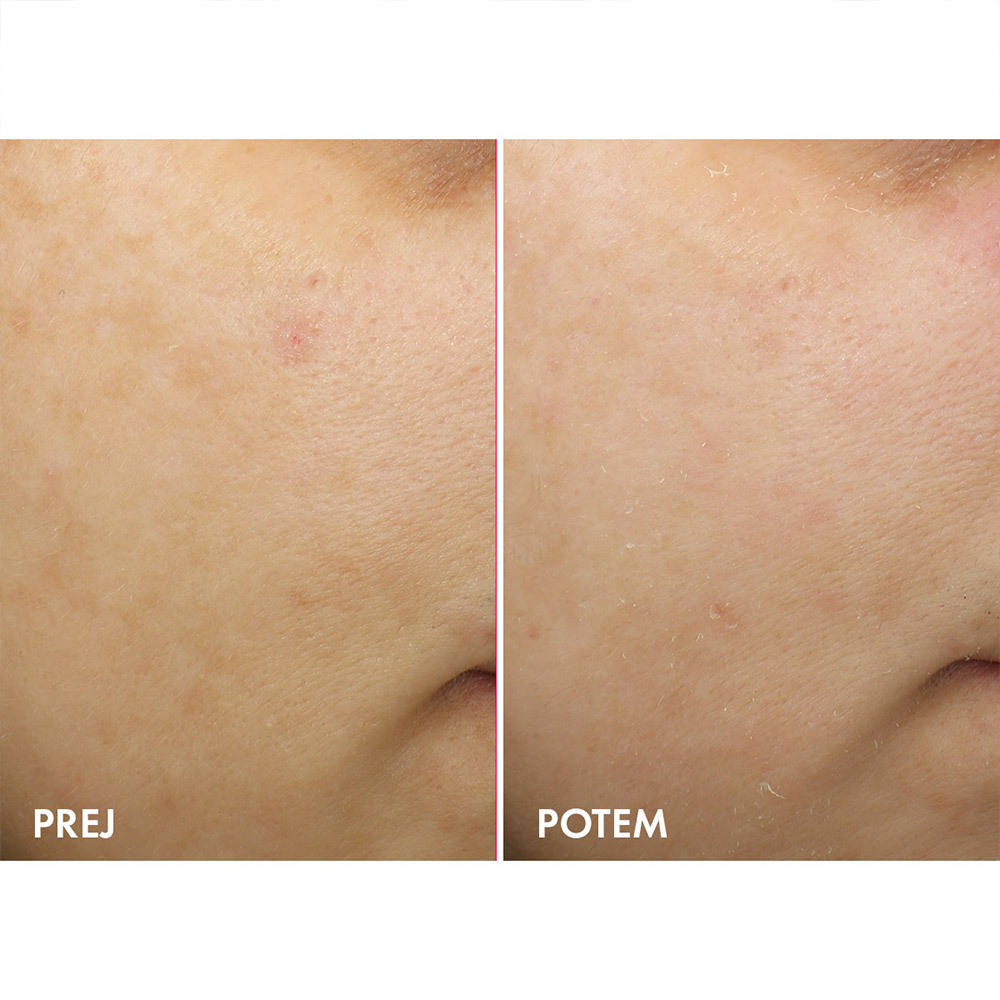 Vichy Liftactiv B3 Anti-Dark Spots, nočna krema proti hiperpigmentacijskim madežem s čistim retinolom (50 ml)