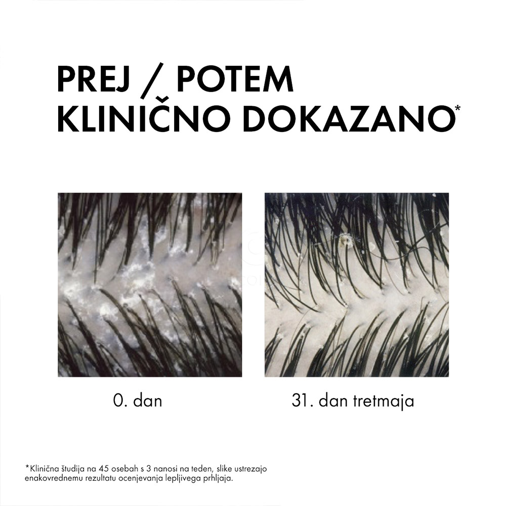 Vichy Dercos DS 2v1, dermokozmetični šampon in balzam proti prhljaju (390 ml)