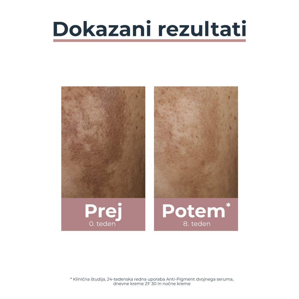 Eucerin Anti-Pigment Dual, serum proti hiperpigmentaciji (30 ml)