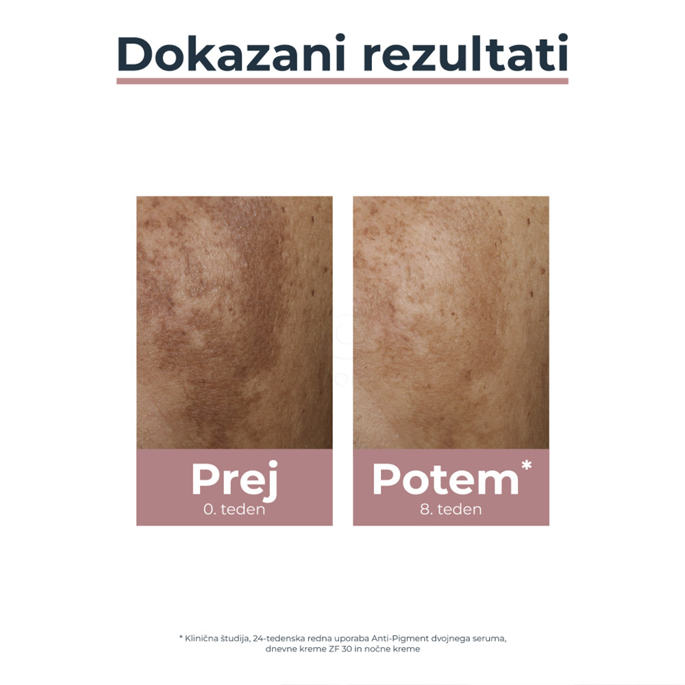 Eucerin Anti-Pigment, dnevna krema - ZF30 (50 ml)