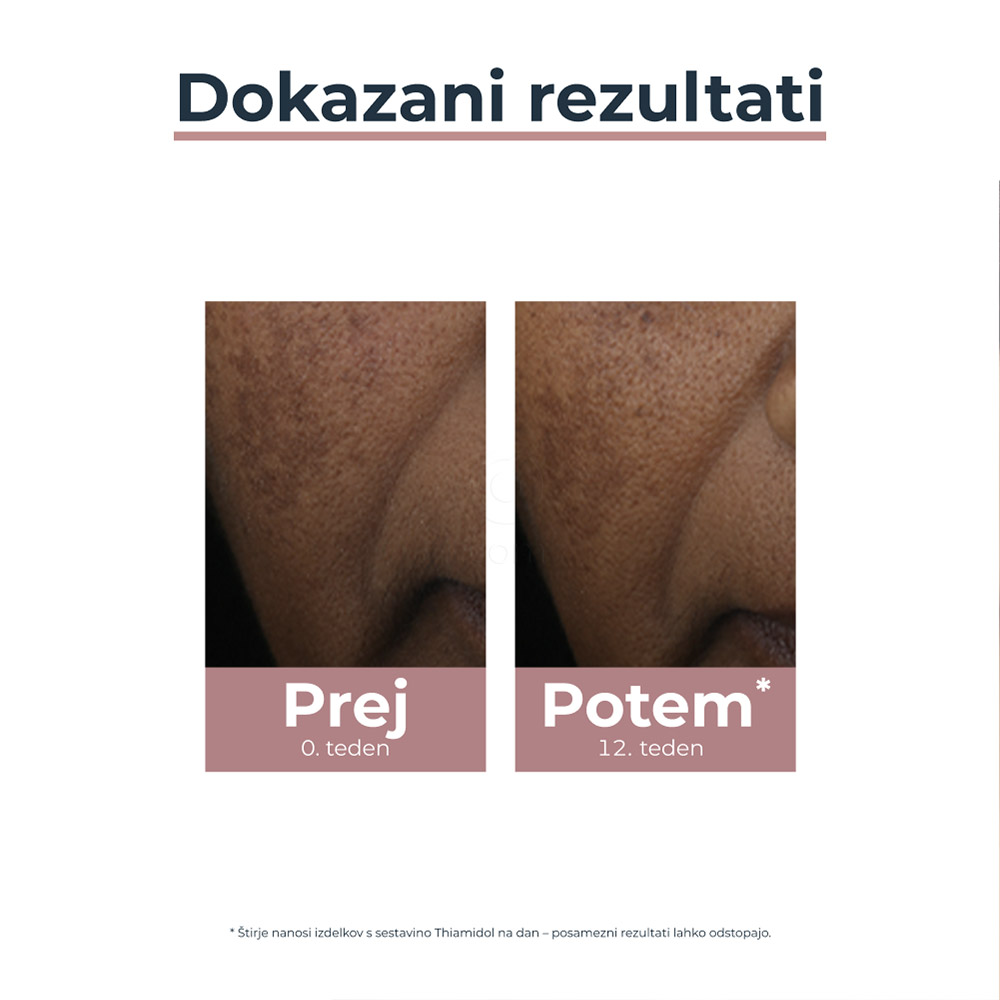 Eucerin Anti-Pigment, korektor proti pigmentnim madežem (5 ml)