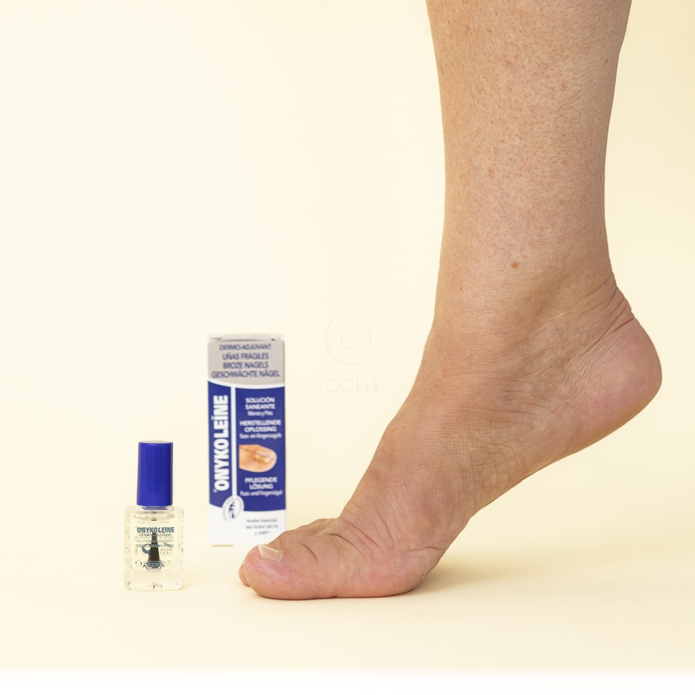 Onykoleine, nega glivičnih nohtov (10 ml)
