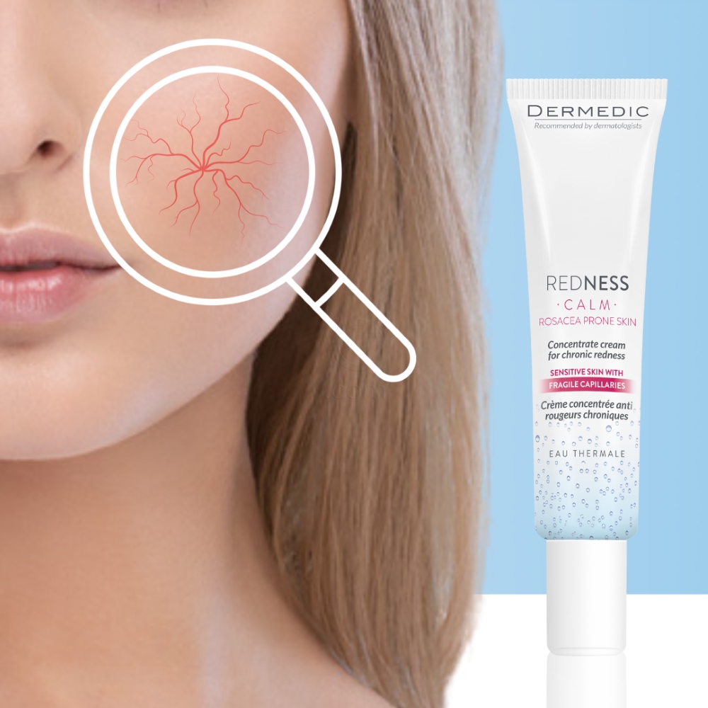 Dermedic Redness, koncentrirana krema proti rdečici (40 ml)