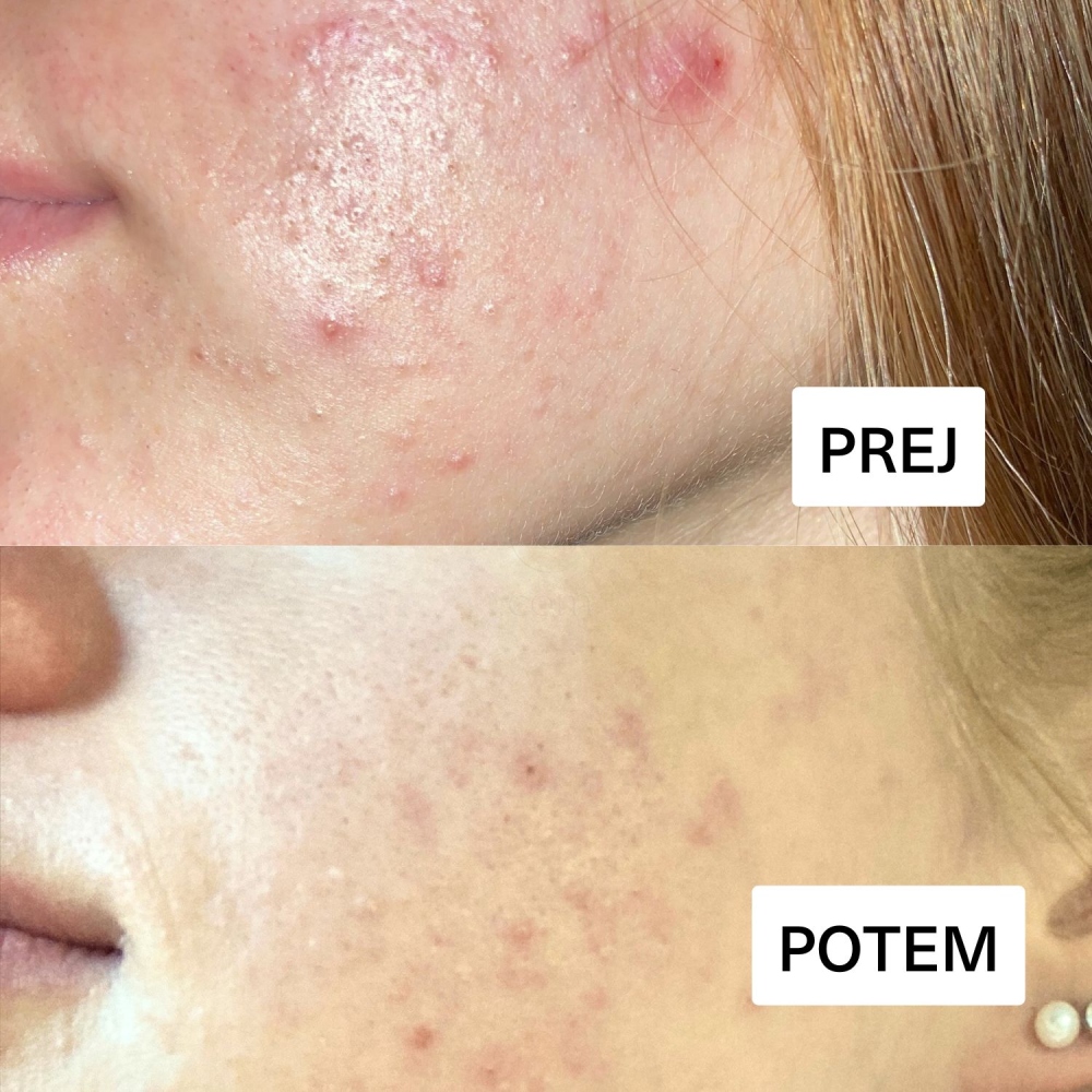 Hemptouch, negovalni duo za ravnovesje kože (50 ml + 100 ml)