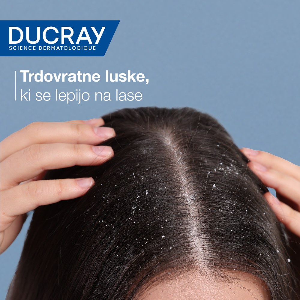 Ducray Kelual Squanorm, regulirajoči tretma šampon proti mastnemu prhljaju (200 ml)