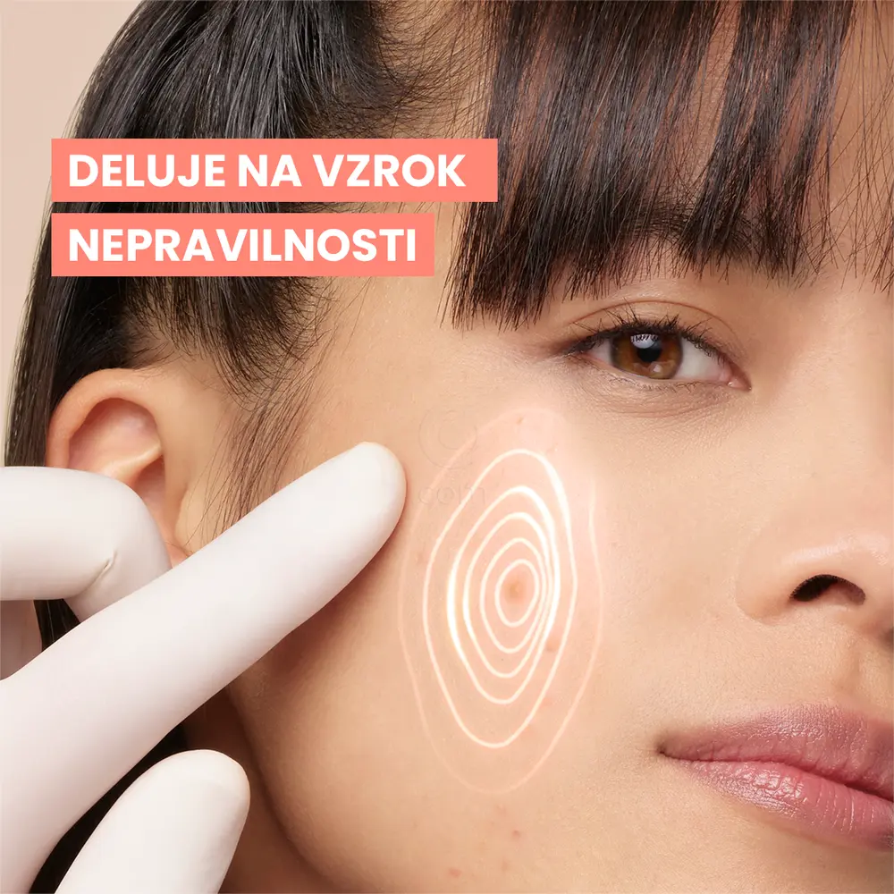 Avene Cleanance Comedomed+, intenzivna nega proti nepravilnostim (30 ml)