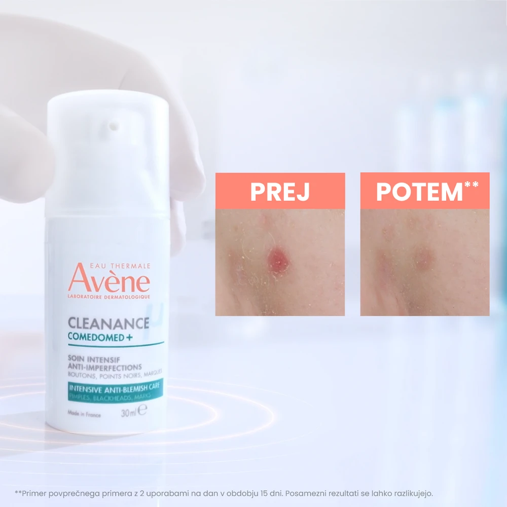 Avene Cleanance Comedomed+, intenzivna nega proti nepravilnostim (30 ml)