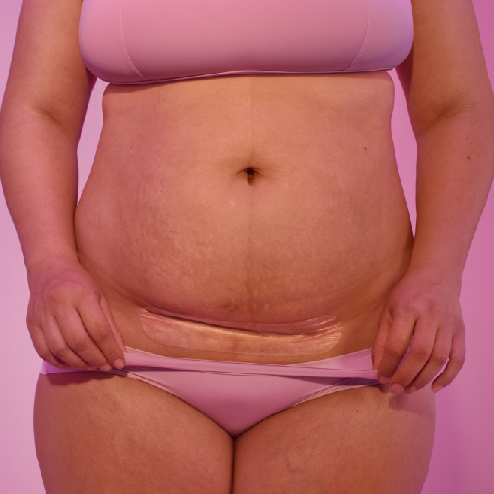 Frida Mom, silikonski obliži za brazgotine po carskem rezu (6 obližev)