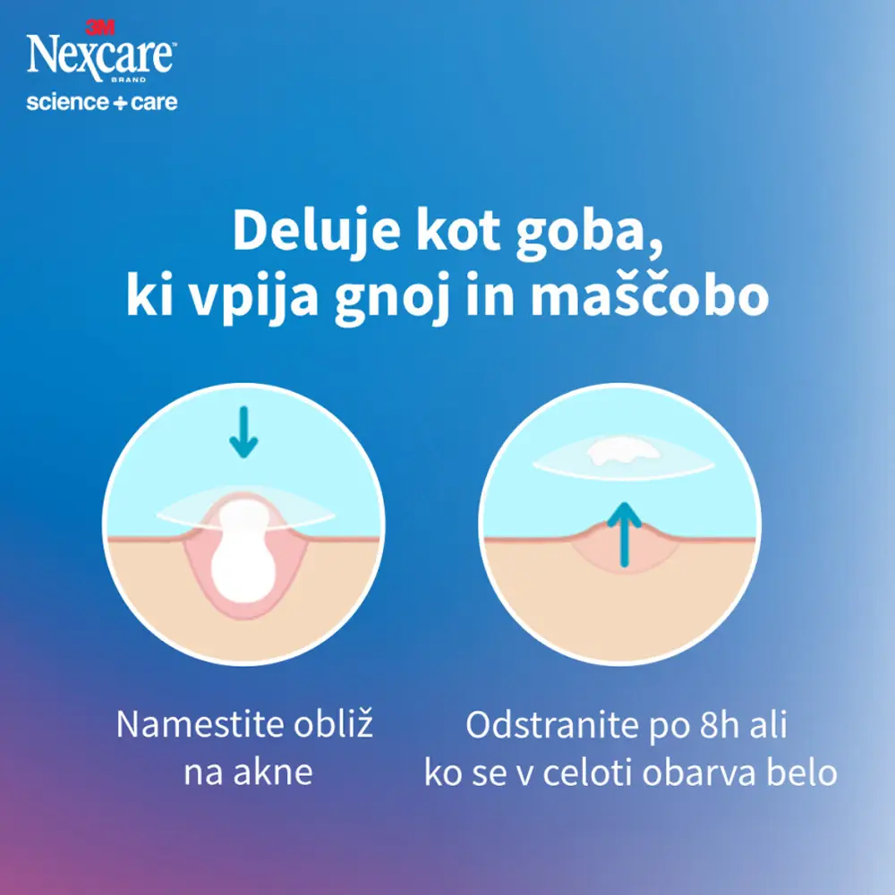 Nexcare Acne  Patch, obliži za akne (15 obližev)