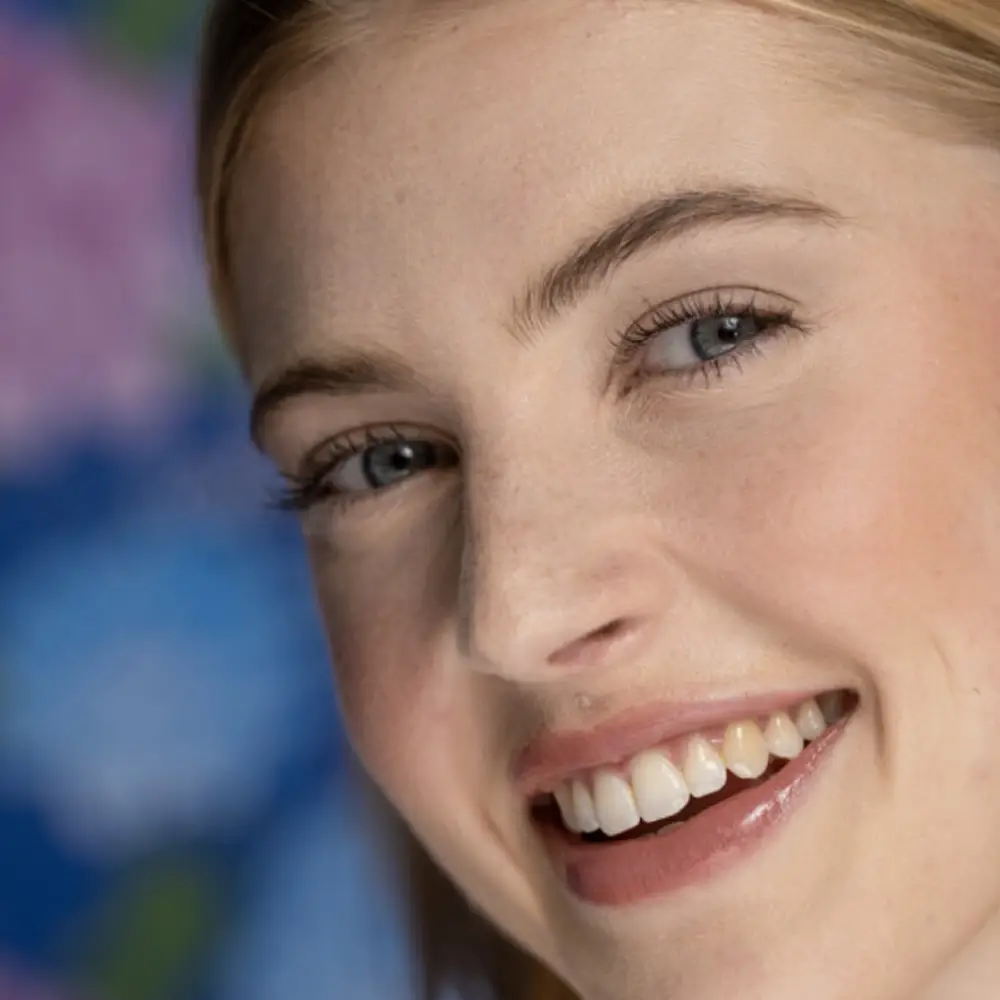 Nexcare Acne  Patch, obliži za akne (15 obližev)