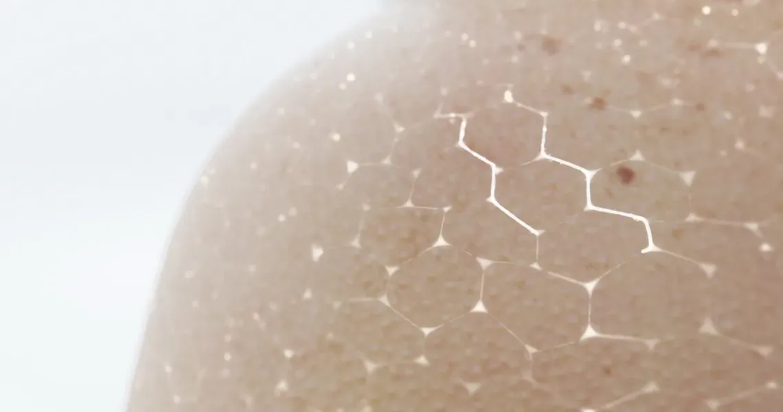 Ceramidi in hialuronska kislina: njihova vloga pri doseganju lepe kože