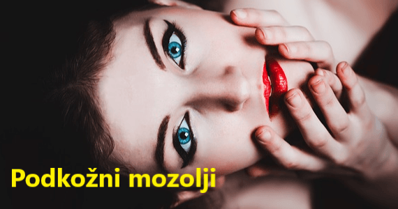 Tur ali boleč podkožni mozolj: 6 nasvetov kako se ga znebiti