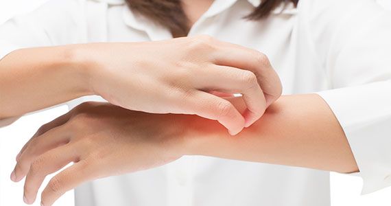 Nega pordele in srbeče kože.